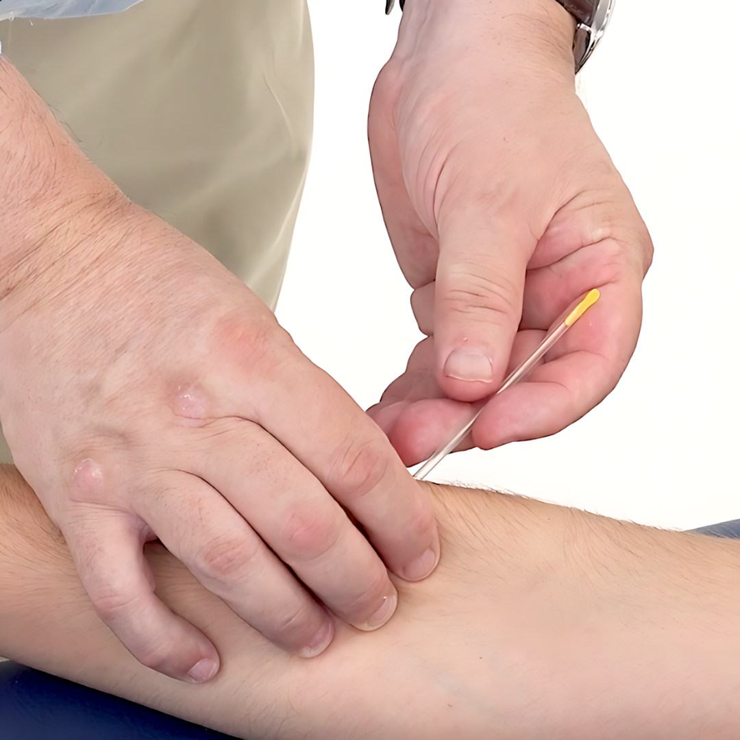 Trigger Point Dry Needling - IMS (18 hrs) - Concordia Style Boutique