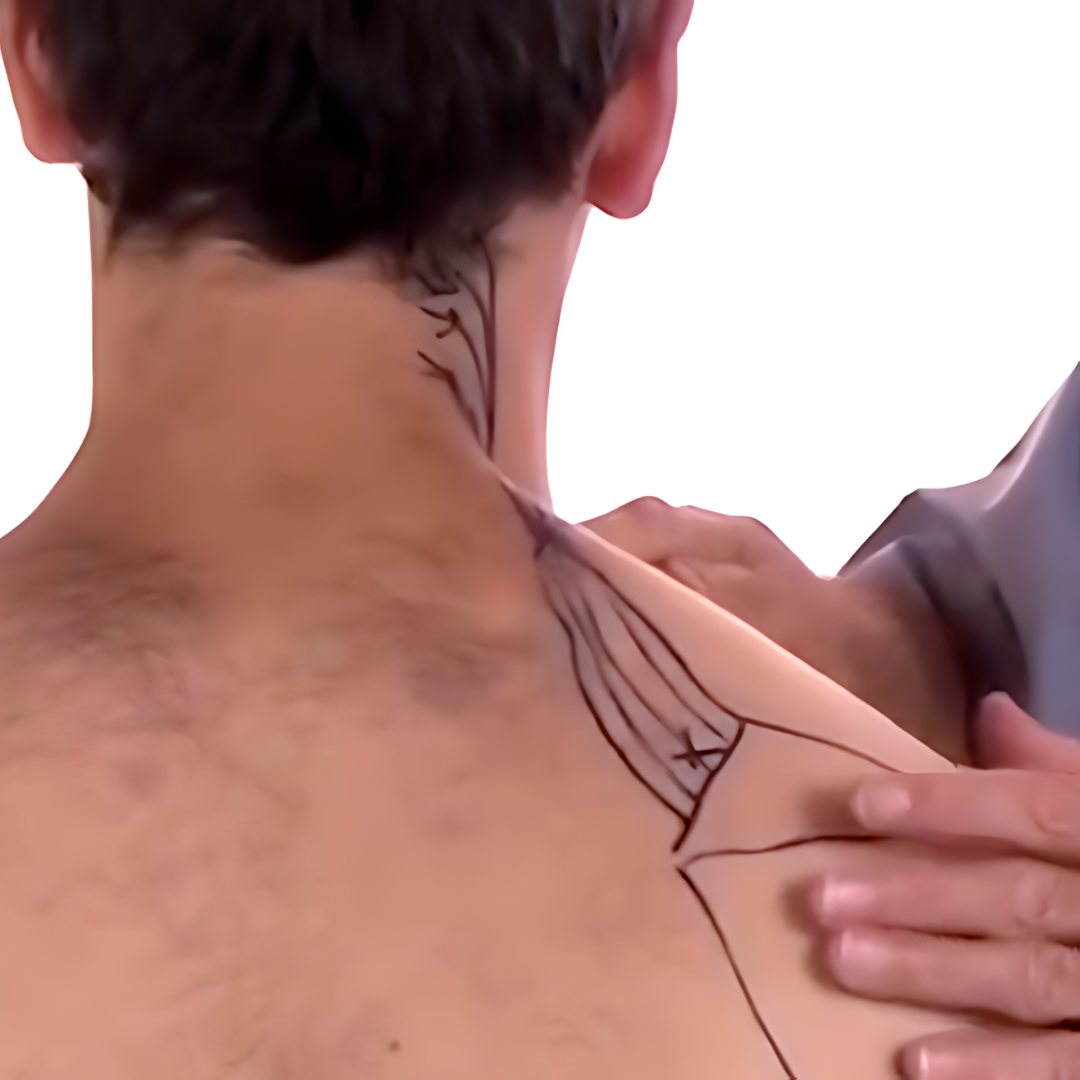 Tension Headache and Trigger Points (4 hrs) - Concordia Style Boutique