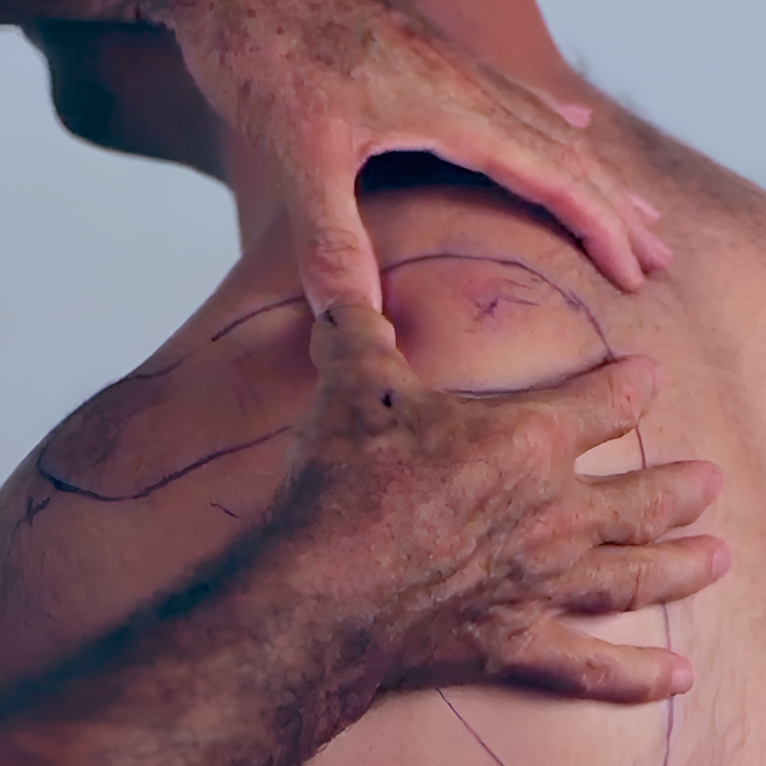 NAT Treating the Rotator Cuff (4 hrs) - Concordia Style Boutique