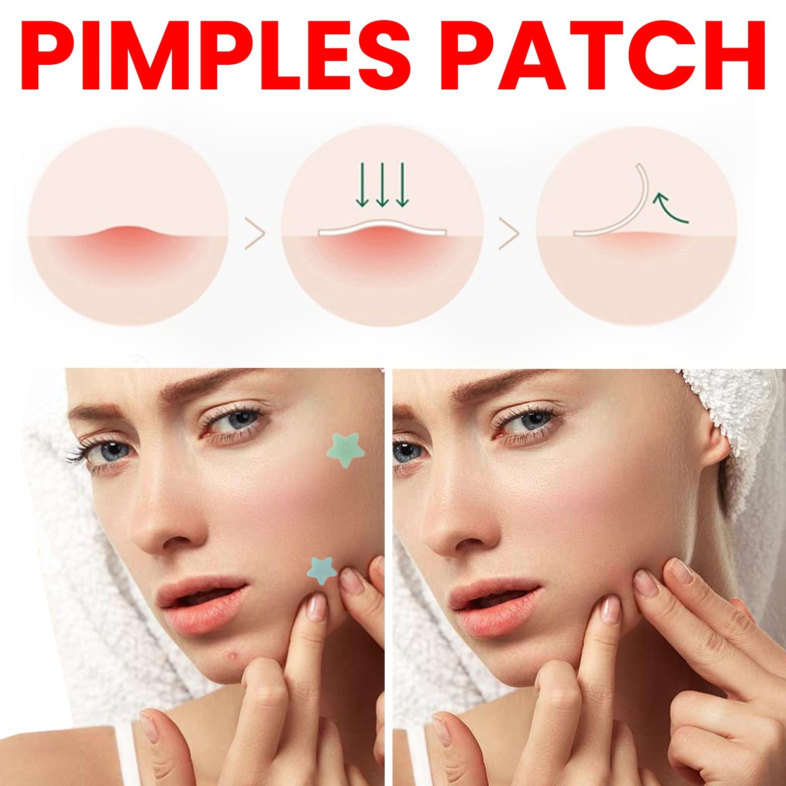 Jaysuing Repair Acne Patch – Effective Acne Treatment & Pimple Mark Fader - Premium Acne Patch from Concordia Style Boutique - Just $12.52! Shop now at Concordia Style Boutique