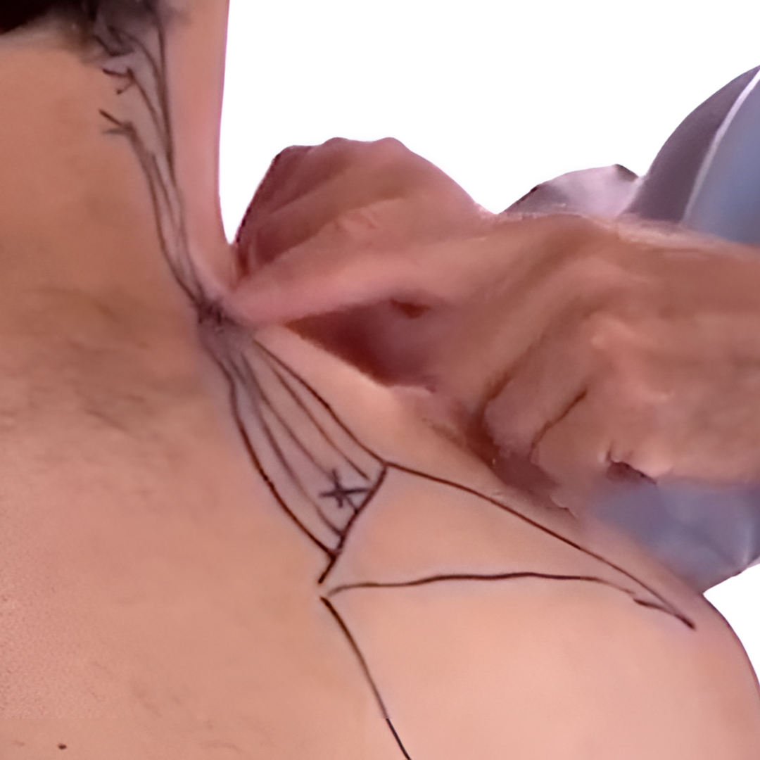 Tension Headache and Trigger Points (4 hrs) - Concordia Style Boutique