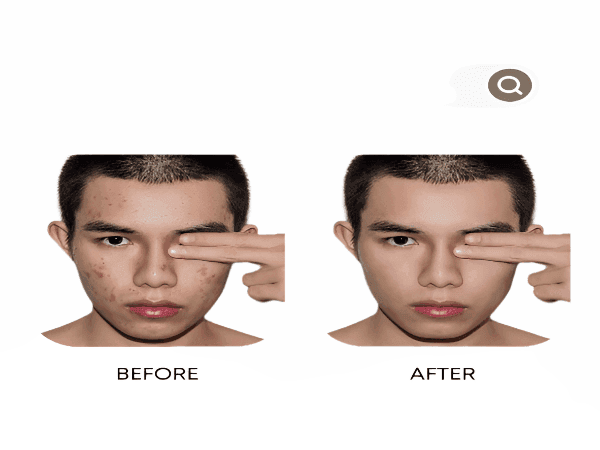 Anti-Acne Organic Facial Wash - For MEN - Concordia Style Boutique