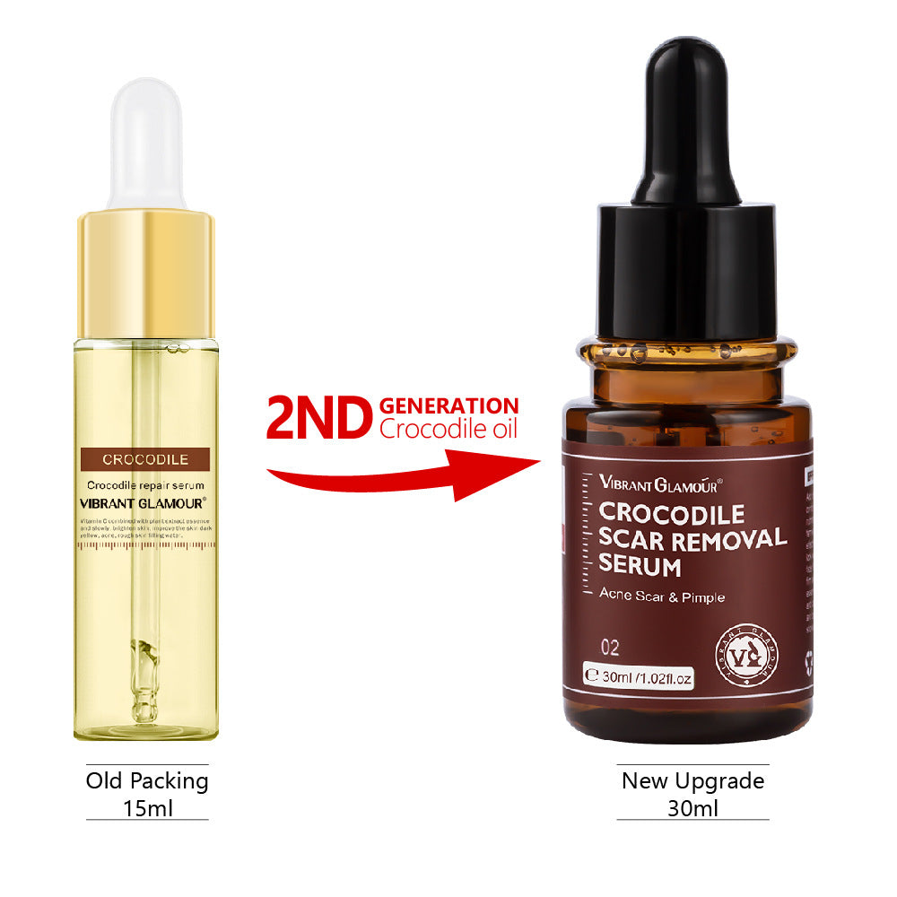 Face Spot Remover & Skin Repair Serum – Acne, Keloid & Scar Healing Treatment (1.02 fl oz) - Premium Face Spot Remover from Concordia Style Boutique - Just $10.16! Shop now at Concordia Style Boutique