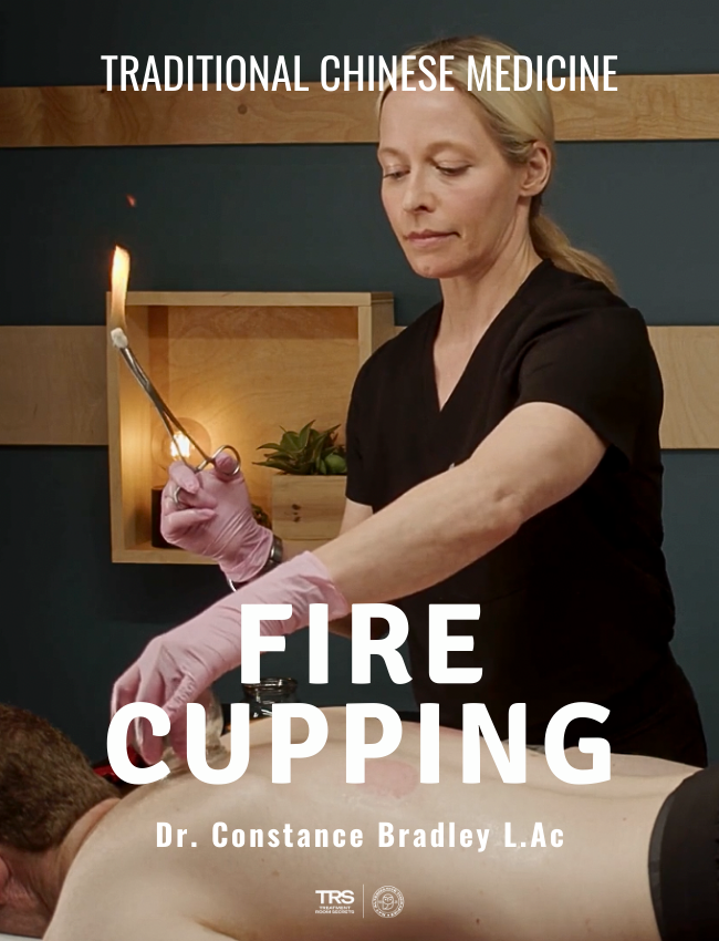 TCM Fire Cupping (5 hrs) - Concordia Style Boutique