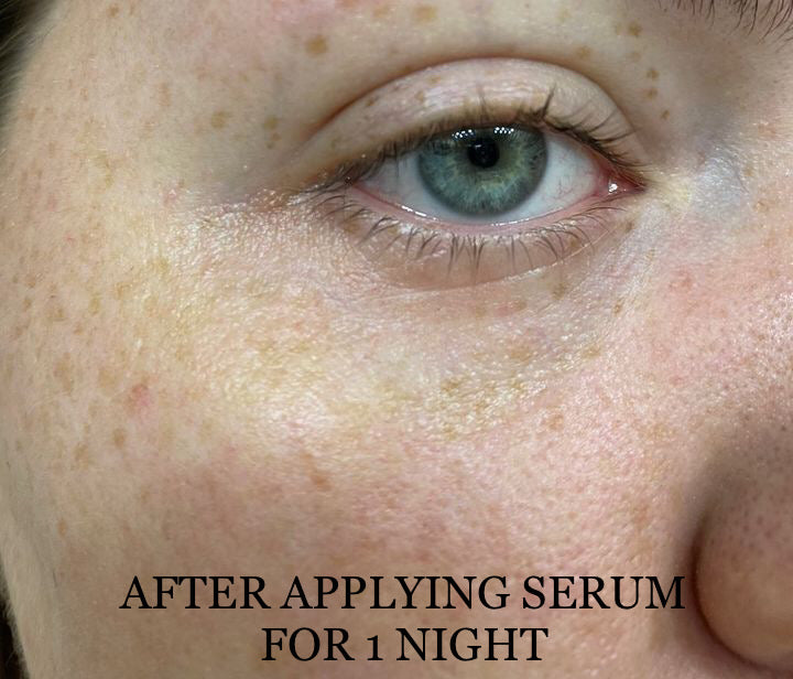 NEW Shwally Methylene Blue Repair Serums