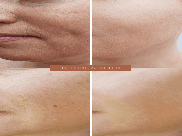 ORGANIC HYALURONIC WRINKLE DEFIER - For Women and Men - Concordia Style Boutique