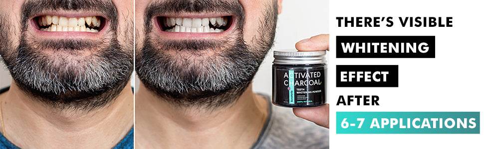 Teeth Whitening Powder - Tooth Whitening 5 in 1 Formula | Blanqueador de Dientes | Charcoal Toothpaste Alternative | Sensitivity Treatments - Concordia Style Boutique