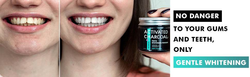 Teeth Whitening Powder - Tooth Whitening 5 in 1 Formula | Blanqueador de Dientes | Charcoal Toothpaste Alternative | Sensitivity Treatments - Concordia Style Boutique