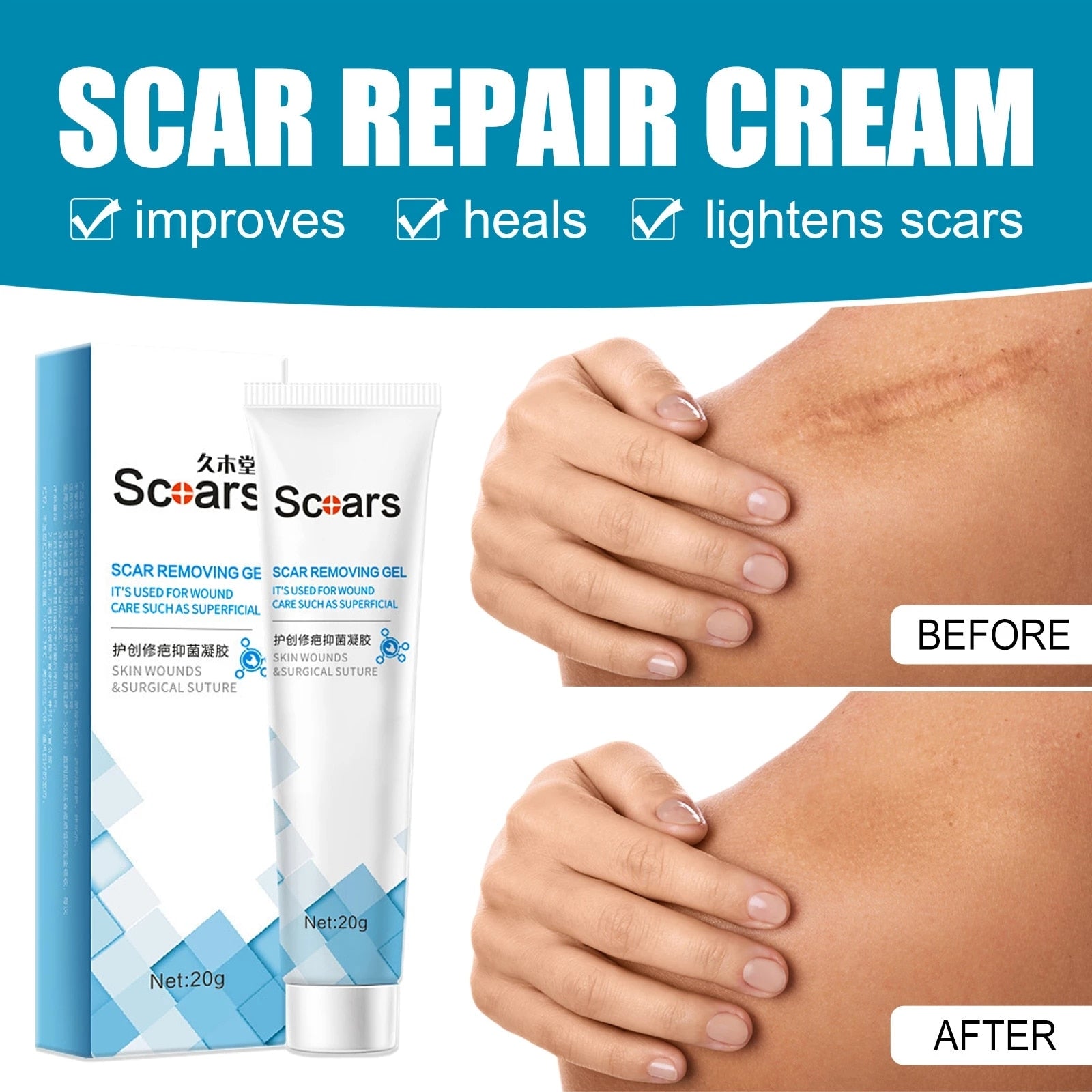 New Herbal Scar Repair Cream - Premium  from Concordia Style Boutique - Just $19! Shop now at Concordia Style Boutique