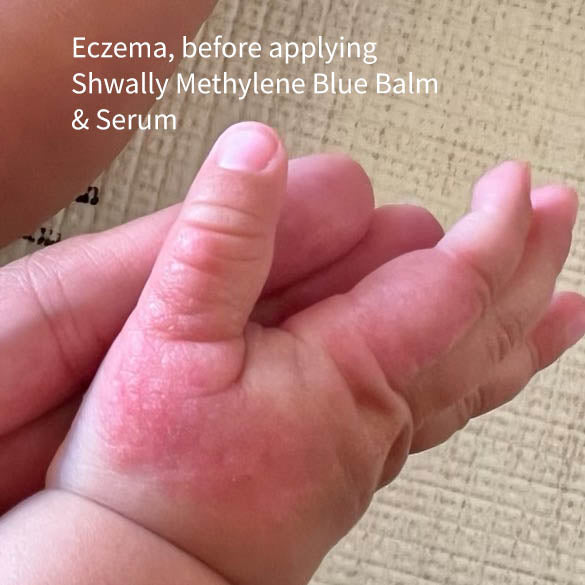 NEW Shwally Methylene Blue Repair Serums