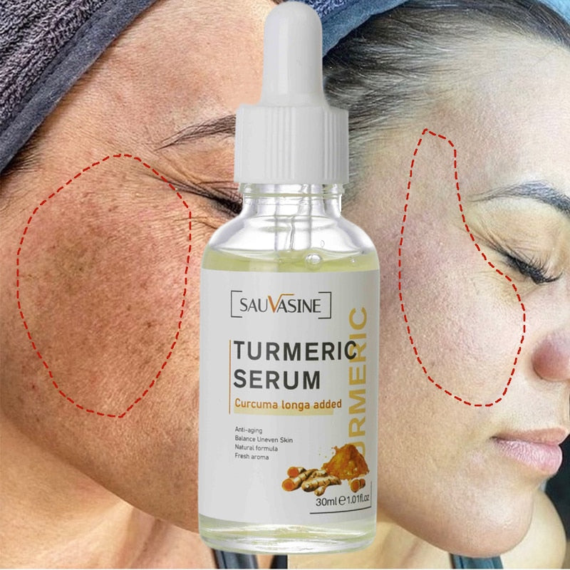 Turmeric Face Whitening Serum - Premium Turmeric Face Whitening Serum from Concordia Style Boutique - Just $17.85! Shop now at Concordia Style Boutique