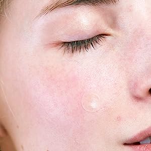 Mighty Patch™ Invisible+ patch from Hero Cosmetics - Daytime Hydrocolloid Acne Pimple Patches for Covering Zits and Blemishes, Ultra Thin Spot Stickers for Face and Skin, Vegan-friendly (39 Count) - Premium Hydrocolloid Acne Pimple Patches from Concordia Style Boutique - Just $20.86! Shop now at Concordia Style Boutique