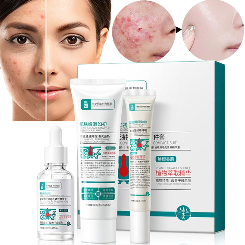 Herbal Acne Removal Face Cream - Premium Herbal Acne Removal Face Cream from Concordia Style Boutique - Just $19.66! Shop now at Concordia Style Boutique