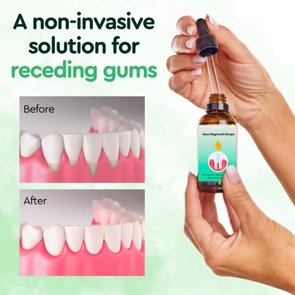 Gum Relief Drops, DentiZen Gum Regrowth Drops, Gum Treatment for Receding Gums, Oil Pulling for Teeth and Gums (2Pcs) - Premium Gum Relief Drops from Concordia Style Boutique - Just $16.13! Shop now at Concordia Style Boutique