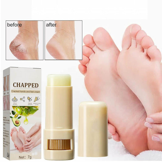 Shea Butter Foot Cracked Cream Moisturizing Nourishing Hand and Foot Care Treatment Stick, Natural Mild Moisturizer Suitable for Rough Dry Chapped Feet - Premium Foot Cream from Concordia Style Boutique - Just $7.36! Shop now at Concordia Style Boutique