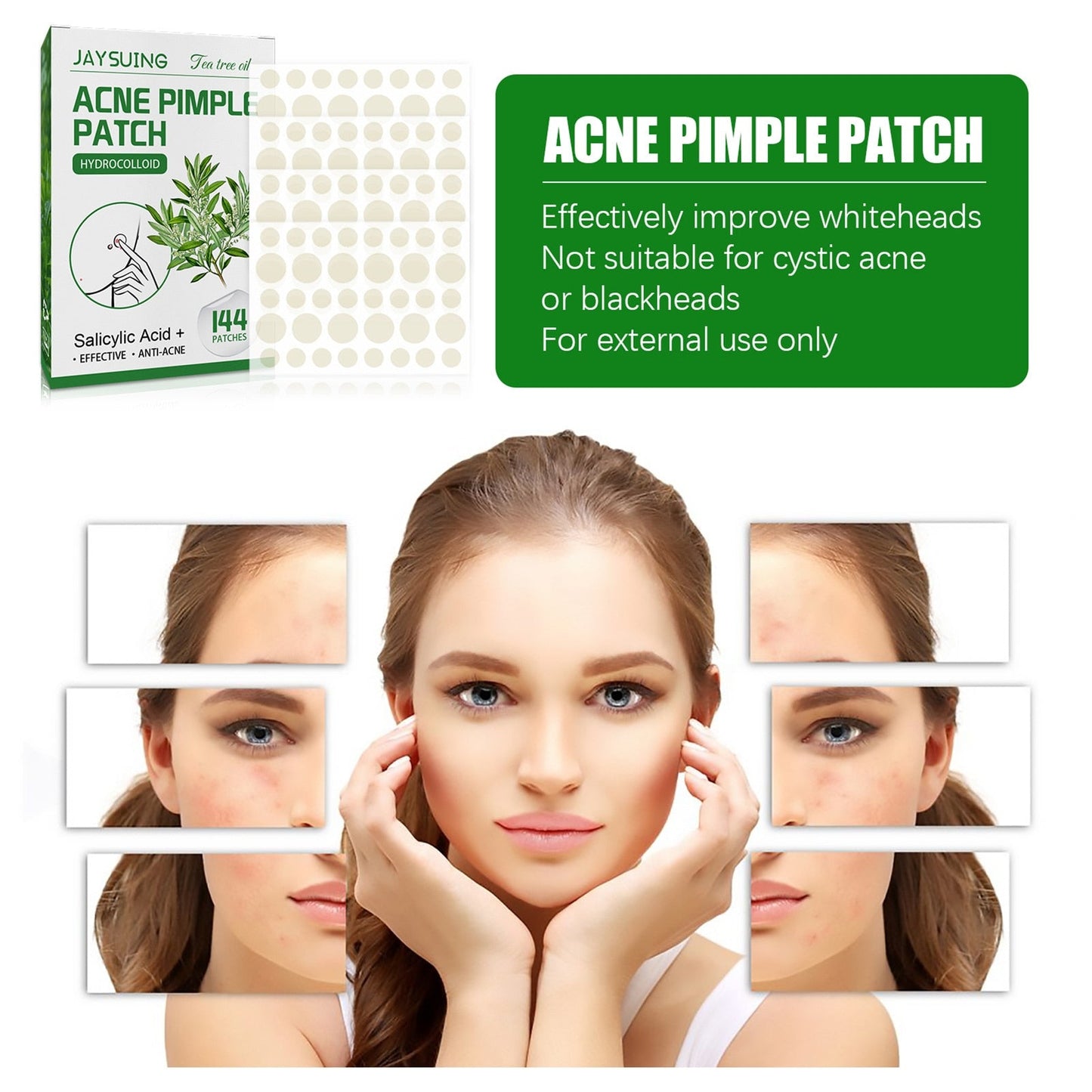 Acne Pimple Patches - Premium Acne Pimple Patches from Concordia Style Boutique - Just $7.30! Shop now at Concordia Style Boutique