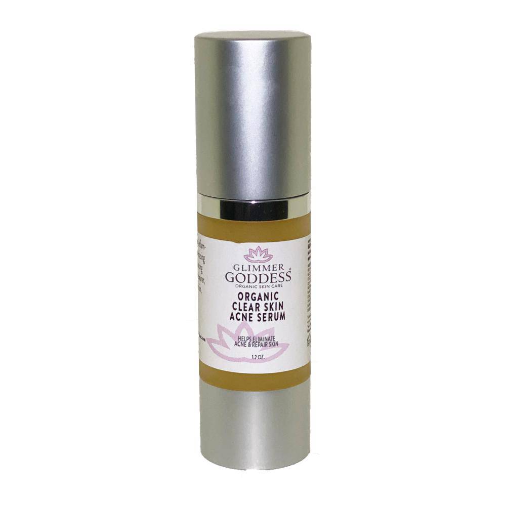 Organic Clear Skin Anti Acne Serum - Oil Regulation Serum - Premium  from Consonance Store - Just $53.47! Shop now at Concordia Style Boutique