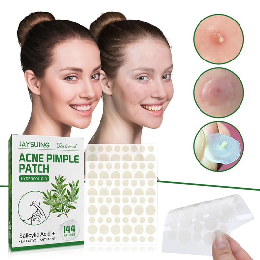 Acne Pimple Patches - Premium Acne Pimple Patches from Concordia Style Boutique - Just $7.30! Shop now at Concordia Style Boutique